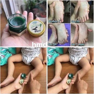 Dầu trị côn trùng đốt