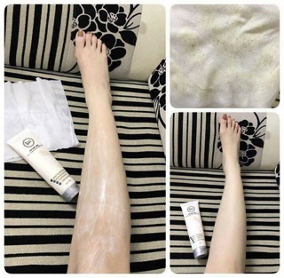 Triệt lông My Miu.