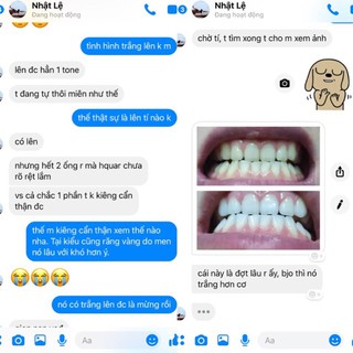 [Sốc] Máy tẩy trắng răng Nhật Bản