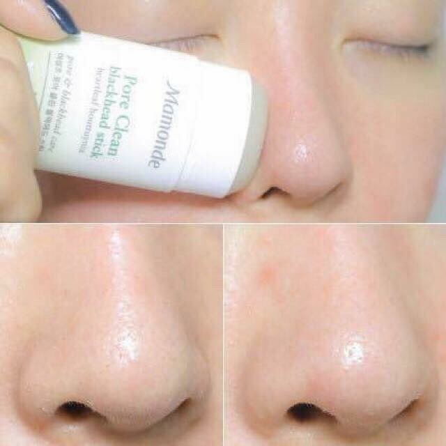 THANH LĂN MỤN ĐẦU ĐEN MAMONDE PORE