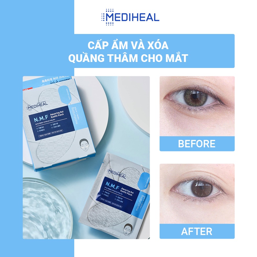 Mặt Nạ Cấp Ẩm Cho Mắt Mediheal N.M.F Aquaring Gel Eye Fill Patch Hộp 5 Túi [K32]