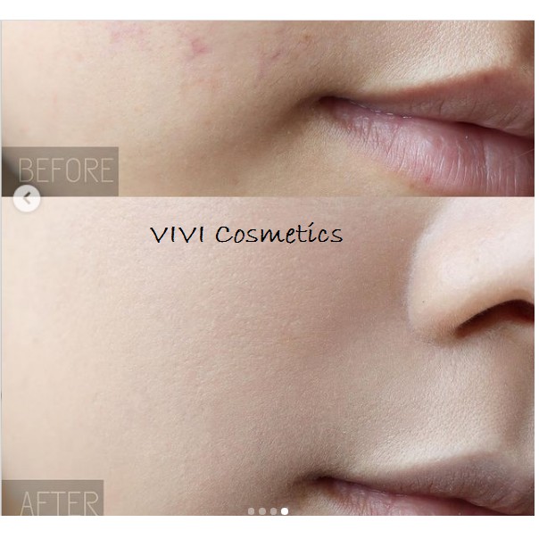 SET Phấn nước STACEY RED NEO CUSHION 15gx2 | BigBuy360 - bigbuy360.vn