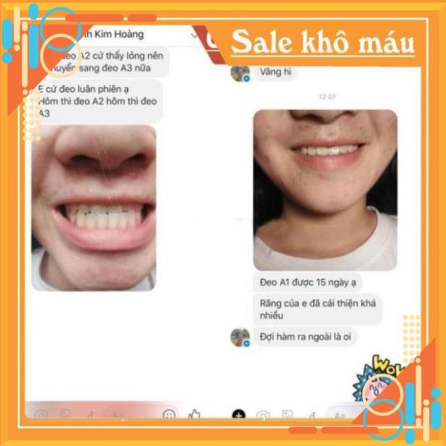 BỘ NIỀNG RĂNG TẠI NHÀ CHO NGƯỜI LỚN - Bộ 3 niềng ++ Tặng 1 dưỡng mắt ốc sên.