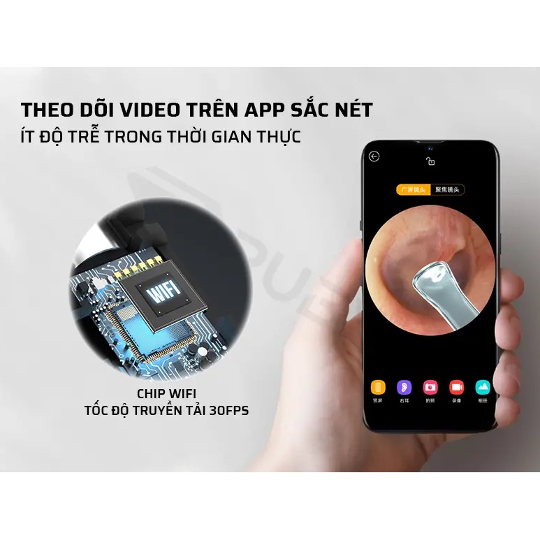 Dụng cụ lấy ráy tai tích hợp camera Bebird R1 -Máy lấy ráy tai xiaomi có  nội soi-Hình ảnh 3.0 Mpx-Bảo hành 12 tháng