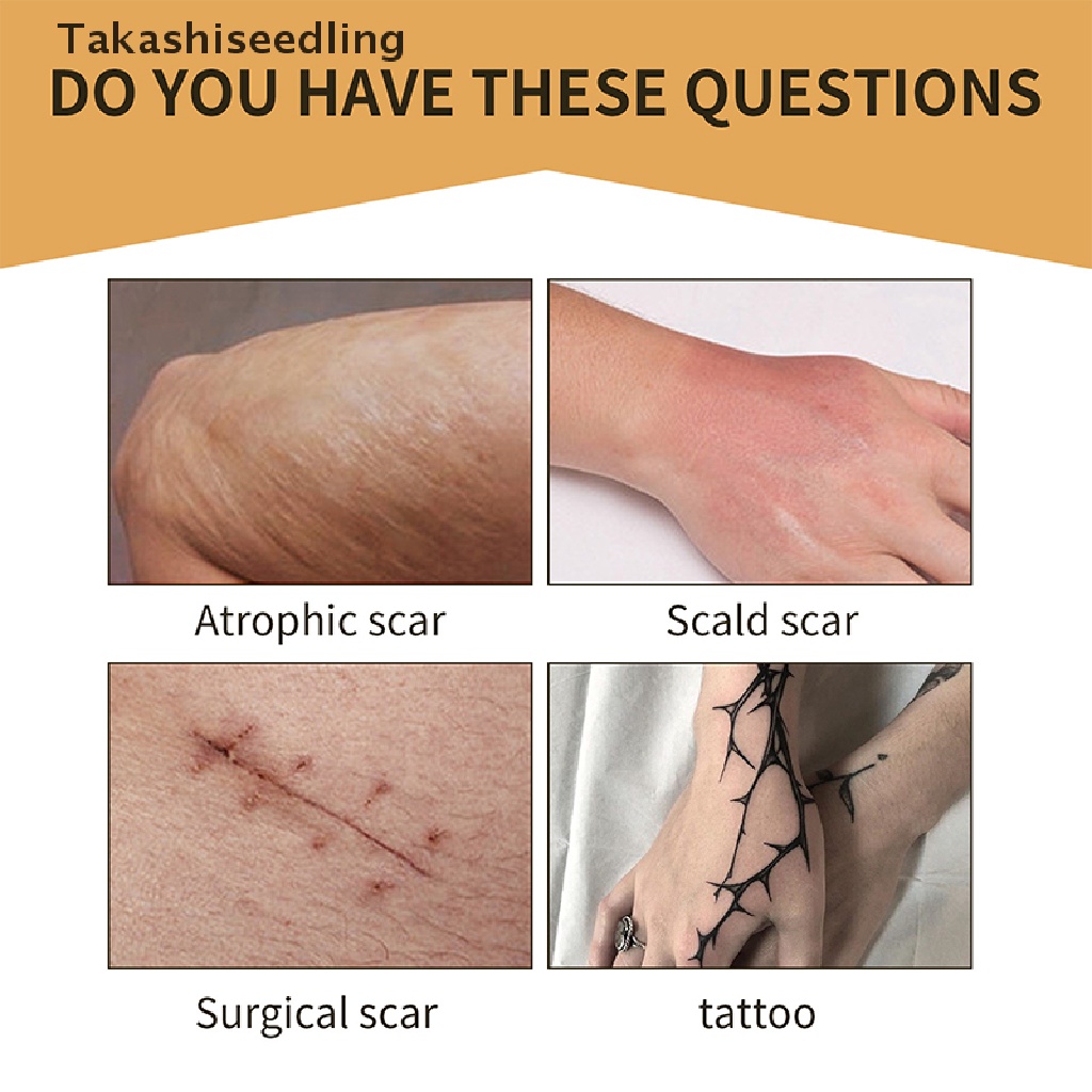 Miếng Dán Che Khuyết Điểm Hình Xăm Bằng Silicone Vô Hình Thoáng Khí Thân Thiện Với Da Chống Nước