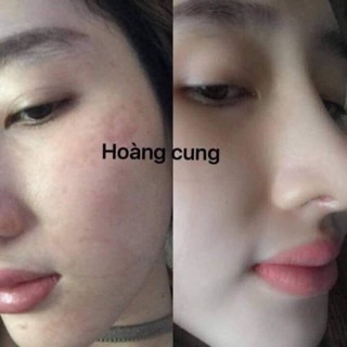 [CHÍNH HÃNG] KEM HOÀNG CUNG CAM