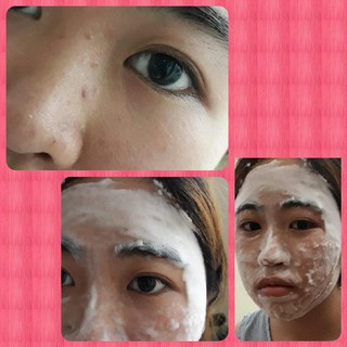 MẶT NẠ THẢI ĐỘC TRẮNG DA DETOX BLANC