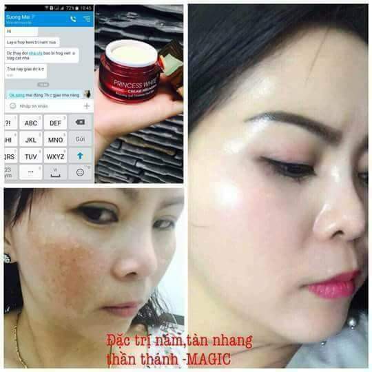 BỘ ĐÔI KẾT HỢP: SERUM 3IN1 & KEM TRỊ NÁM MAGIC “MỜ NÁM TRẮNG DA – CHO NÀNG TRẺ RA” | BigBuy360 - bigbuy360.vn