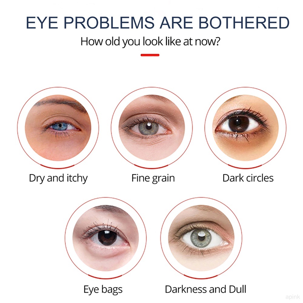 Kem Dưỡng Da Mắt 15g Loại Bỏ Quầng Thâm Bọng Mắt Chống Nếp Nhăn Và Lão Hóa Cho Nam