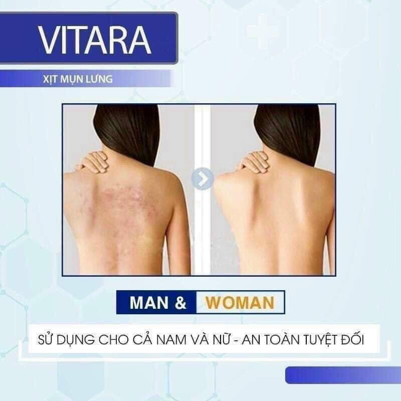 Xịt mụn lưng Vitara - hàng chuẩn mới về