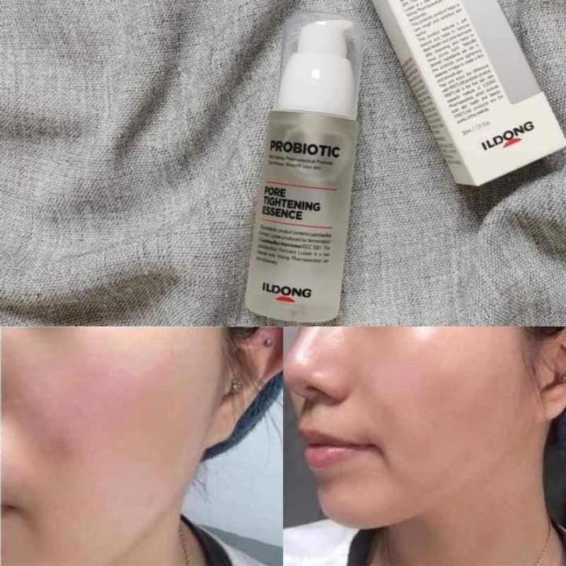 Tinh Chất Men Vi Sinh ILDong Probiotic Pore Tightening Essence