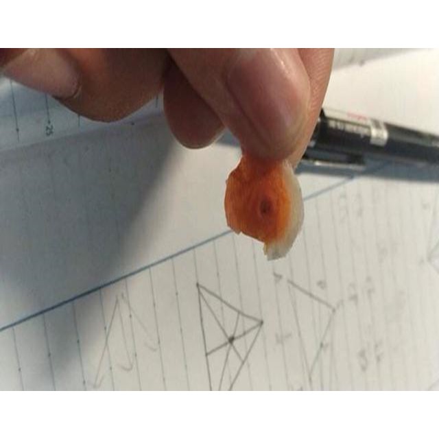 Có Bill- Miếng dán mụn cóc,mắt cá chân, chai sần tay chân CONR CAPS của Anh Quốc