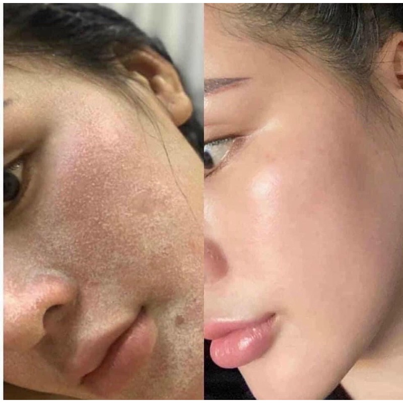 Kem Tái Tạo Da Đông Y Cao Cấp Kim Spa Mụn Nám Tàn Nhang