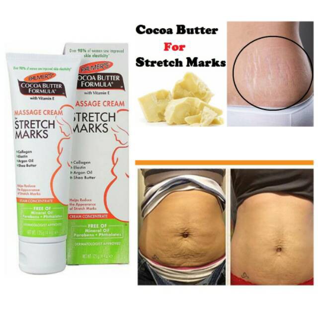 Kem rạn da bà bầu Palmer’s Massage - Palmer’s Cocoa Butter Formula Massage Lotion For Stretch Marks 5.0