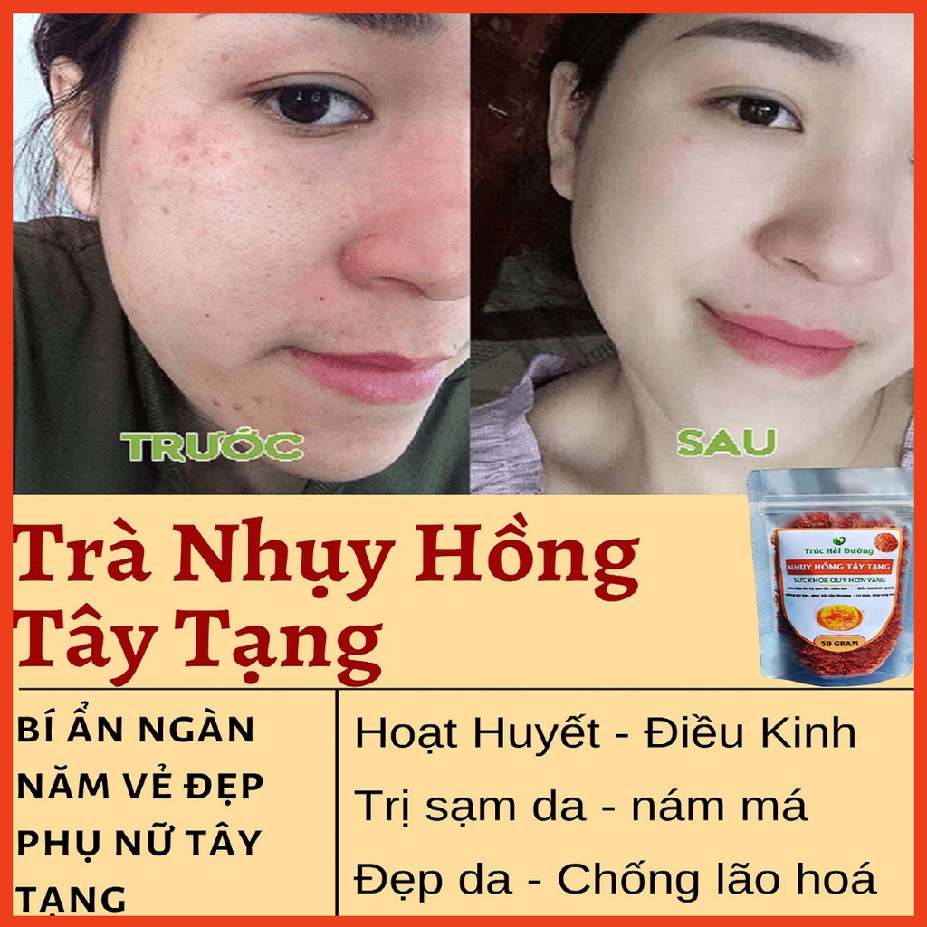 ✅[HÀNG CAO CẤP] Trà Nhụy Hoa Hồng Tây Tạng Loại Thượng Hạng 50g Pha Cúc Hoa, Mật Ong Điều Kinh, Khắc Tinh Sạm Da, Nám Má | BigBuy360 - bigbuy360.vn