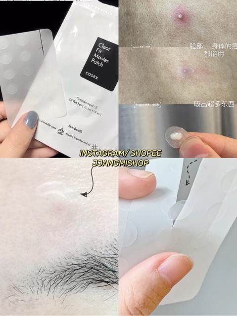 [Có sẵn] Miếng Dán Mụn Cosrx Acne Pimple Master Patch | BigBuy360 - bigbuy360.vn