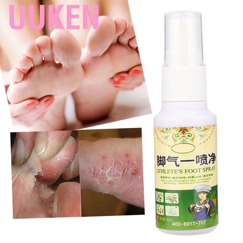 (Hàng Mới Về) Chai Xịt Khử Mùi Hôi Chân Chiết Xuất Thảo Dược 30ml