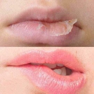 SON MỠ HƯƠU " THẦN THÁNH "