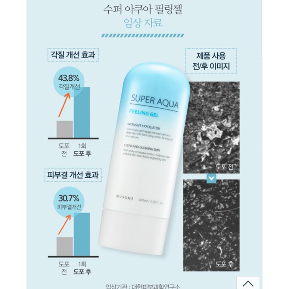 Tẩy da chết Misha