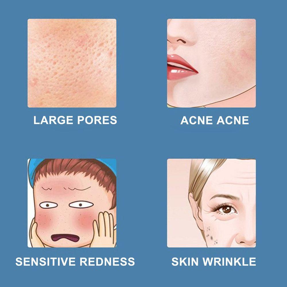 Máy Phun Sương Nano Dưỡng Ẩm Chống Nếp Nhăn Chăm Sóc Da Mặt