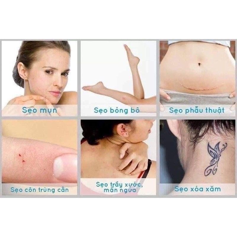 Gel mờ sẹo Urgo Scarfrom: ngừa sẹo nhập khẩu  Pháp