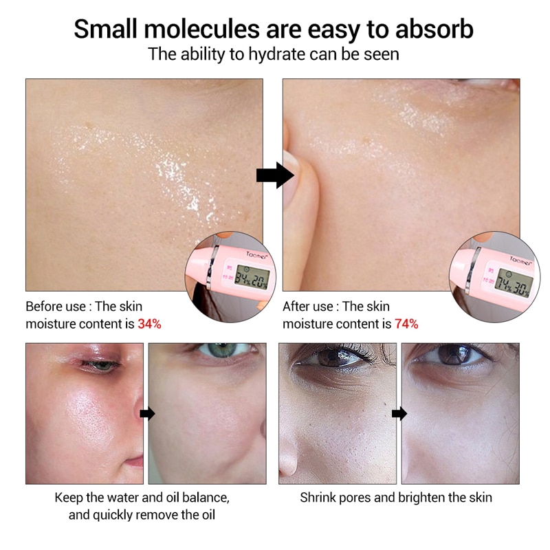 Tinh chất VENZEN axit hyaluronic dưỡng ẩm làm trắng da nâng cơ chống nếp nhăn chăm sóc da khô 15ml