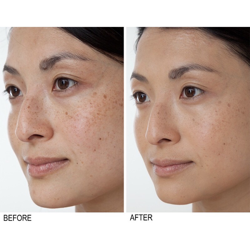 [HàngMỹ]Kem dưỡng sáng da làm mờ thâm nám Neutrogena Rapid Tone Repair Correcting Cream 48g