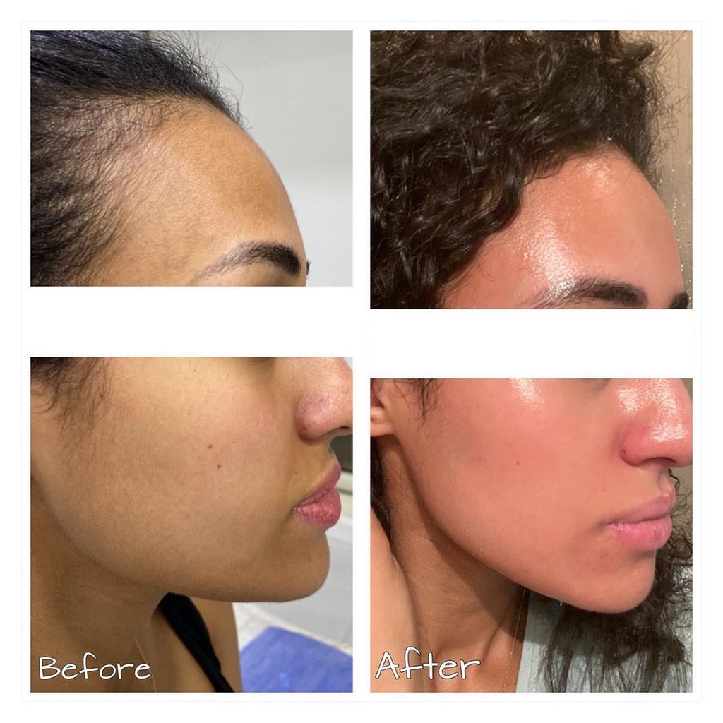 Kem dưỡng Retinol zo Skin Brightener 50ml dưỡng sáng da, chống lão hóa