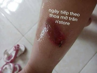 Mỡ trăn Nstore