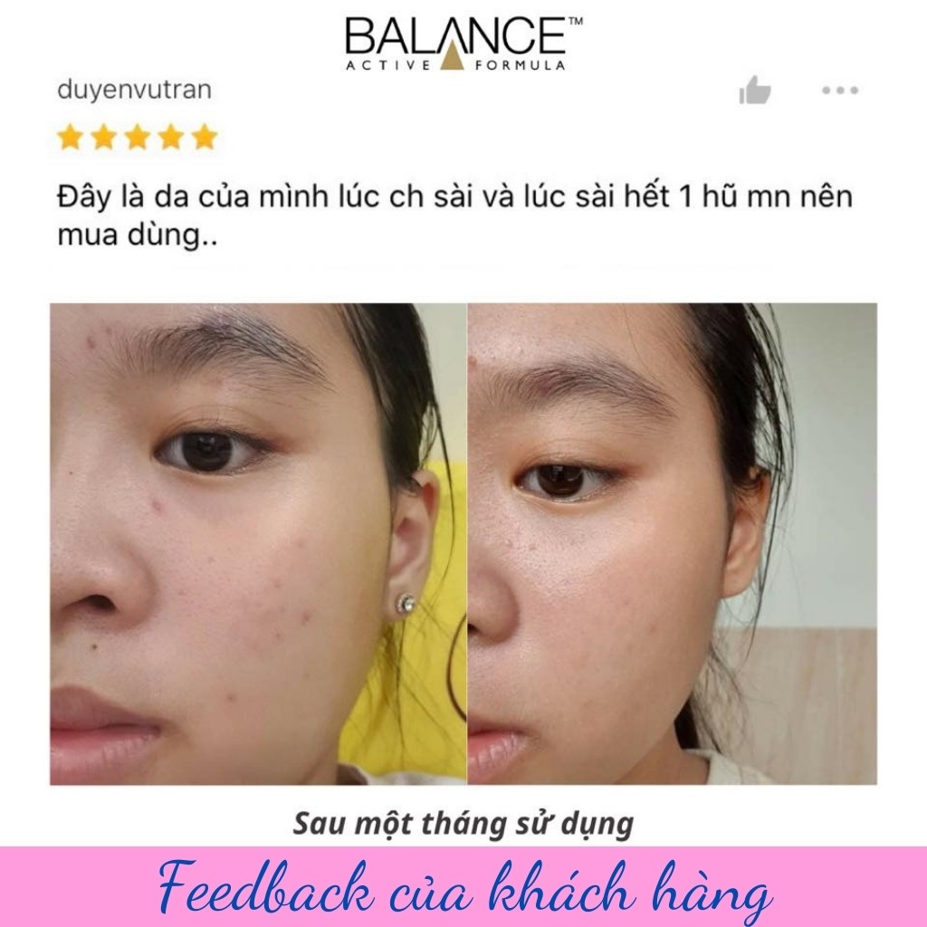 Serum Balance Active Formula vitamin C tinh chất dưỡng trắng da mờ thâm 30ml - ZAVENCI Official | BigBuy360 - bigbuy360.vn