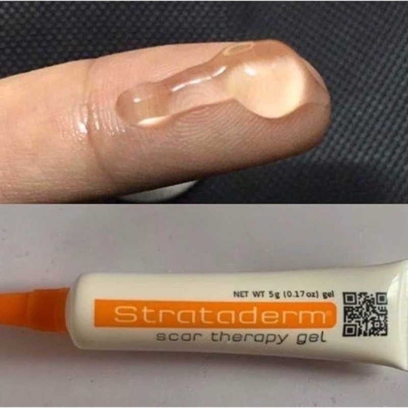 Gel xóa sẹo lồi, sẹo thâm, sẹo rỗ - kem giảm sẹo, nám Strataderm