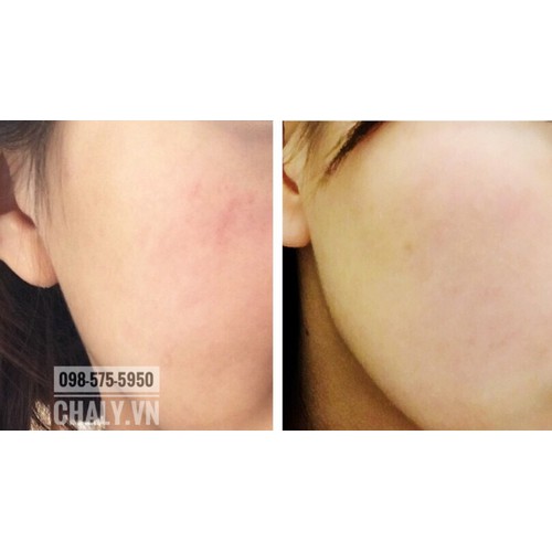 Serum Tunemakers Fullerene trắng da ngăn lão hoá 10ml của Nhật