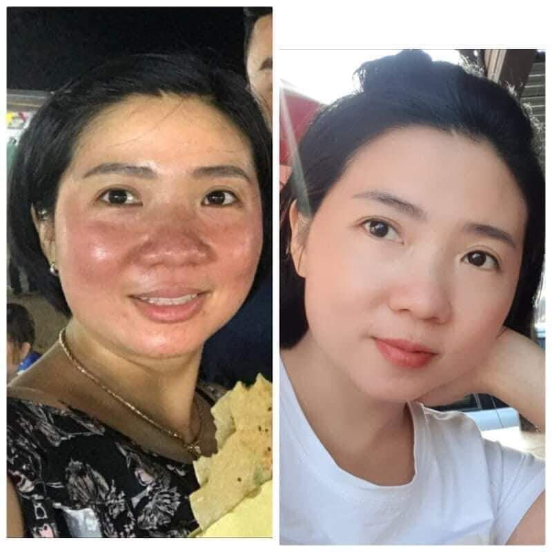 Serum Tái Tạo Da Sâm Cau Rừng MQ Skin 30ml