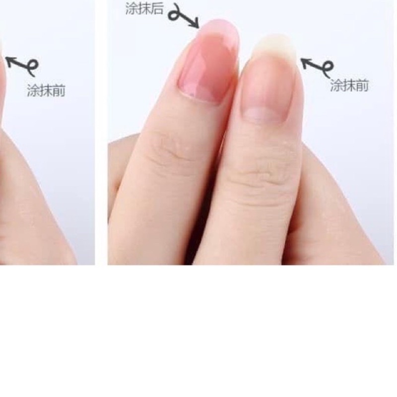 Dầu tháo móng úp
