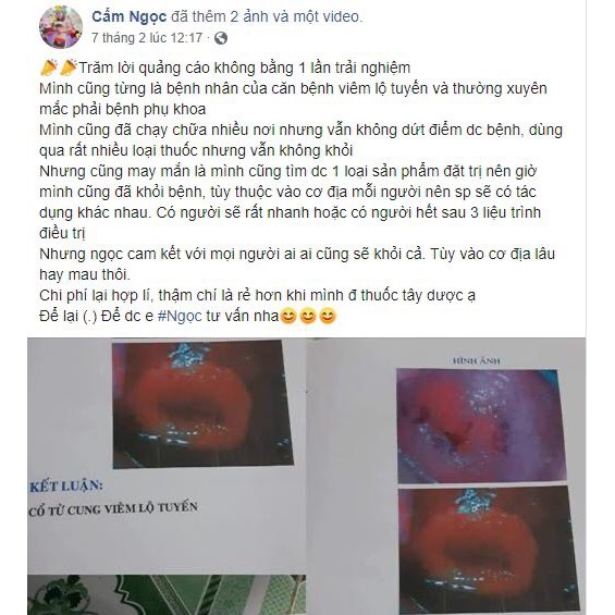 Đũa Thần Tình Yêu Habela