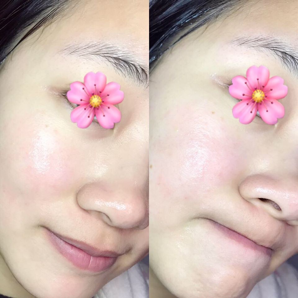 Tinh Chất Eucerin Hyaluron Filler Moisture Booster 30ml