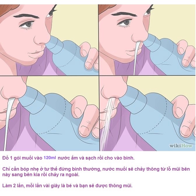 Bộ rửa mũi Neilmed trẻ em