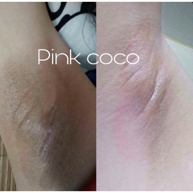 [Free Ship] PINK COCO Kem làm hồng nhũ hoa và bikini vùng kín PINK COCO 20ml(Cả Bộ)