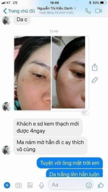 Kem trắng da mặt nhanh | BigBuy360 - bigbuy360.vn