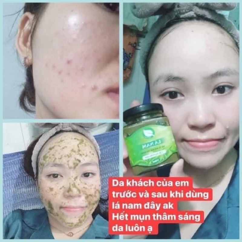 Cao Lá Nam - Xóa bỏ Nám, Tàn nhan và Thâm mụn sau 7 ngày sử dụng