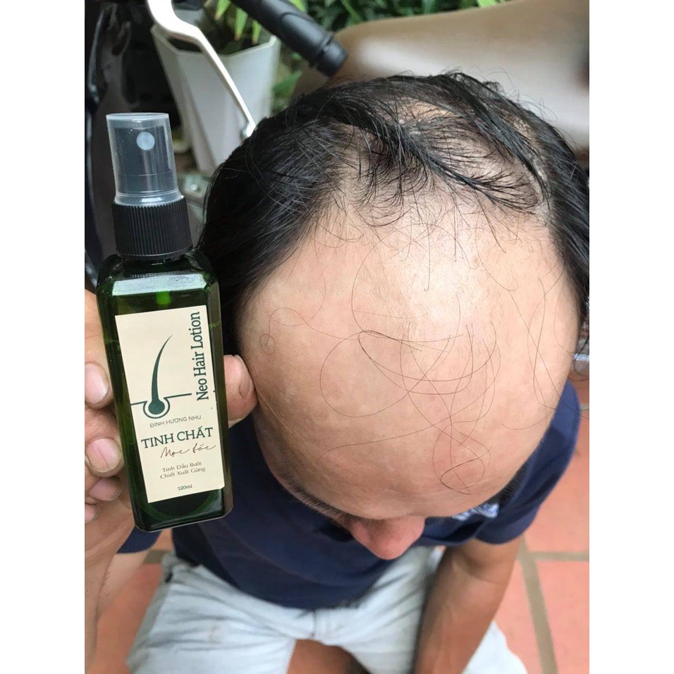 Xịt mọc tóc Đinh Hương Nhu giúp mọc tóc nhanh hơn dài hơn mượt hơn 120ml