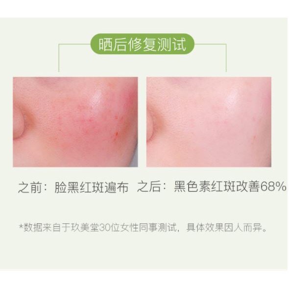 GEL LÔ HỘI 💚FREESHIP💚 gel lô hội zeusee nội địa trung làm mịn da,sáng da,dưỡng ẩm,dịu da