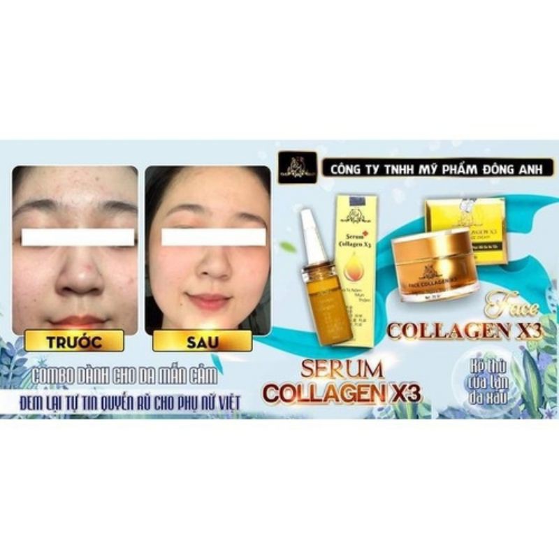Serum Nám Colagen X3 Chính Hãng 20ml | BigBuy360 - bigbuy360.vn