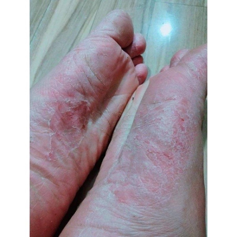 BỘT NGÂM THẢO MỘC TRẦN KIM HUYỀN