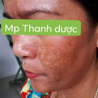 MỸ PHẨM THANH DƯỢC (SERUM LÁRE LỌ 80ML)