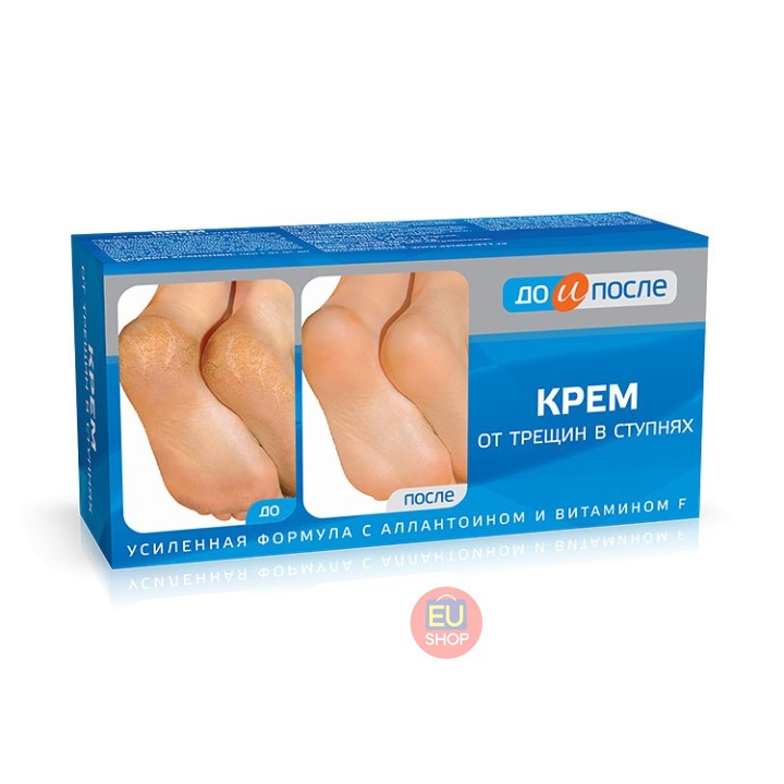 Kem nứt gót chân KPEM Nga  Tuýp 50ml | BigBuy360 - bigbuy360.vn