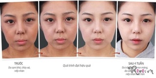 kem sâm Nhật Bản Guoyao Vip