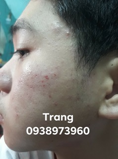 Combo Thuốc Bắc Tái Tạo Da Dưỡng Da