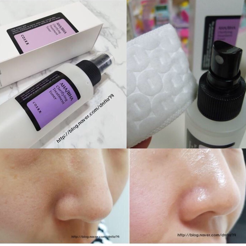 Nước cân bằng Cosrx AHA/ BHA Clarifying Treatment Toner