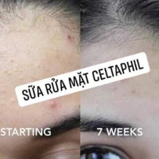 Sữa rửa mặt Cetaphil